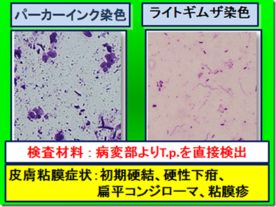 炎 リンパ 硬化 管 陰茎 性 陰茎の硬化性リンパ管炎についてご存知の方よろしくお願いします。