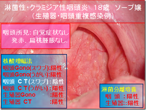 治す 早く 器 精 女性 ヘルペス